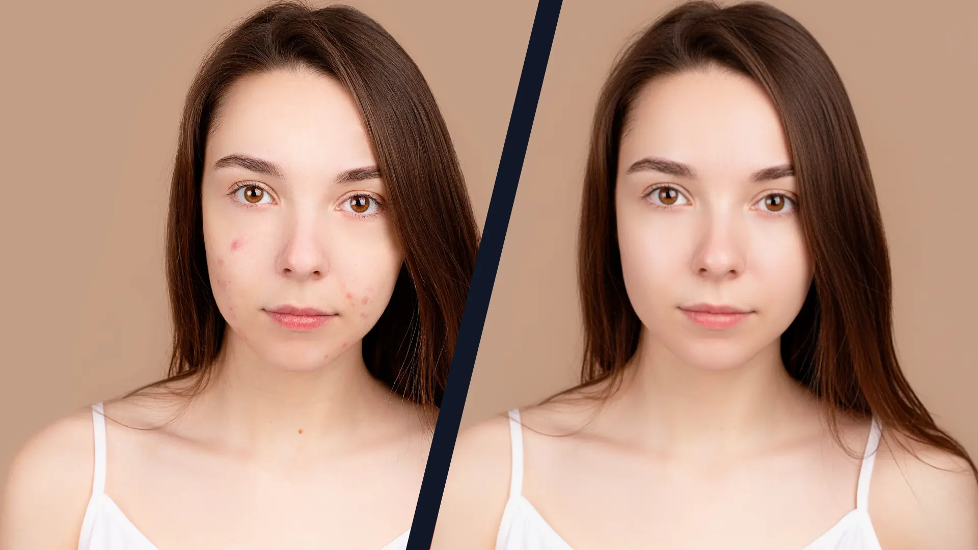 AI Blemish Remover in action removing spots from a portrait