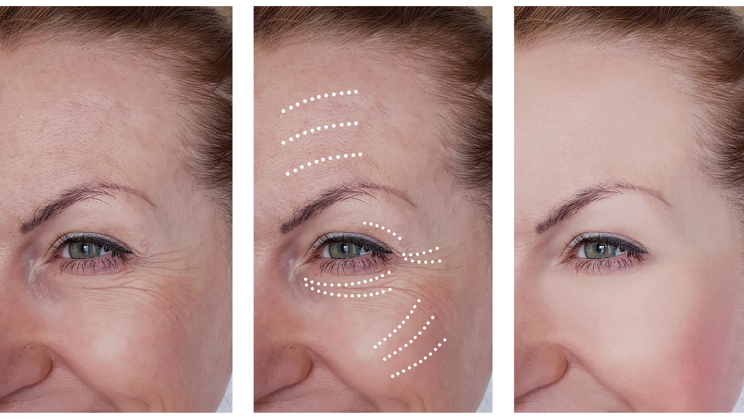 How to use the AI Blemish Remover app